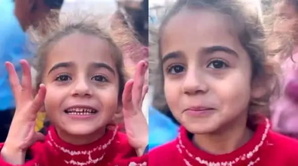 فیلم /  من قبلا خیلی خوشگل بودم موهام بلند بود... / حرف دل جگرسوز دختر بچه جنگ زده از بدبختی هایش !