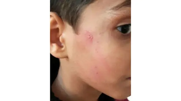 تنبیه شدید یک دانش آموز قزوینی از سوی مدیر مدرسه +عکس
