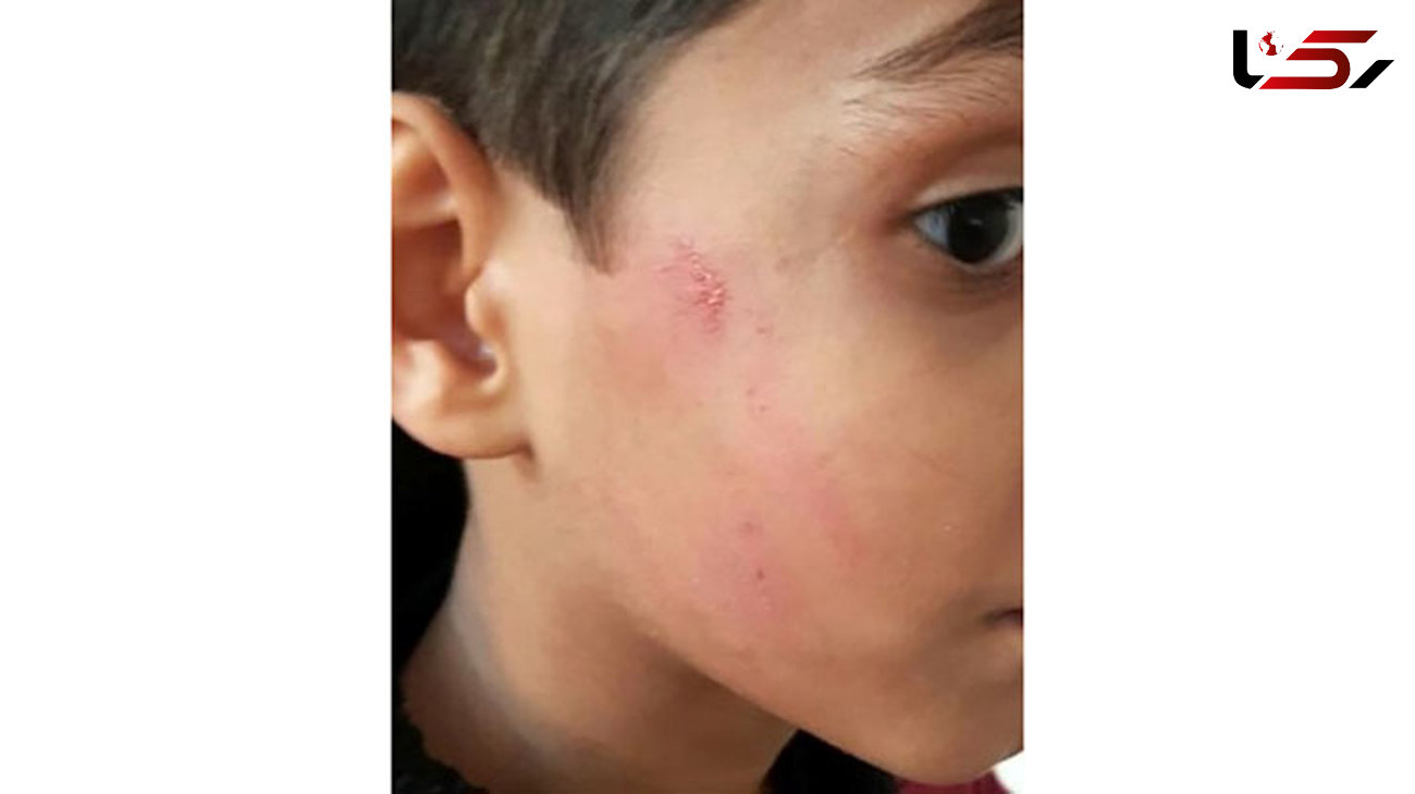 تنبیه شدید یک دانش آموز قزوینی از سوی مدیر مدرسه +عکس
