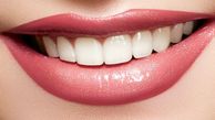 رازهای سفید نگه داشتن دندان ها/بدون هزینه های پزشکی دندان های تان را زیبا کنید!