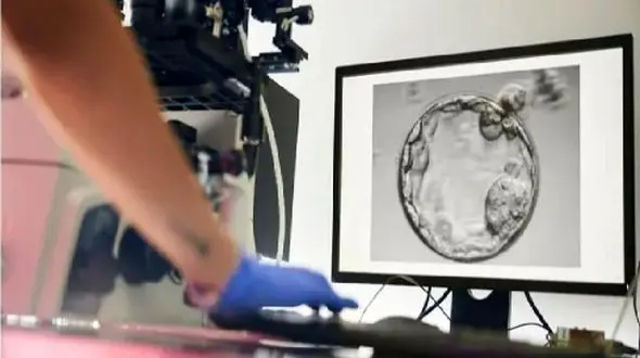 بارداری بعد از 18 سال با پیشرفت‌ های هوش مصنوعی