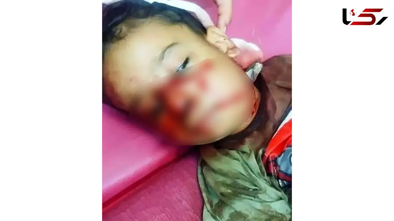 حادثه دلخراش در شوش / سگ مهاجم جان کودک ۴ ساله را تهدید کرد!