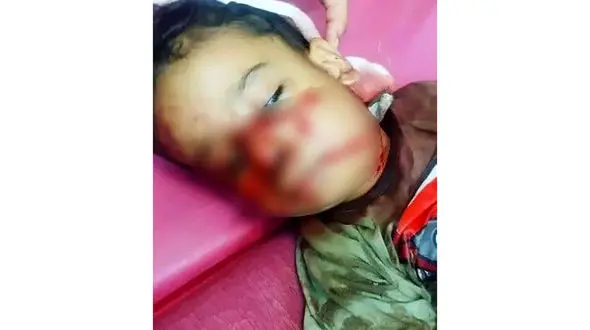 حادثه دلخراش در شوش / سگ مهاجم جان کودک ۴ ساله را تهدید کرد!