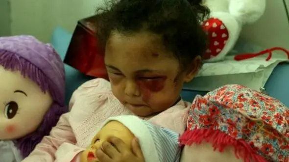 جنگ یمن؛ عکسهایی که عربستان نمی خواهد دیده شوند (گزارش تصویری)