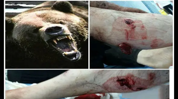 حمله خونین خرس به مرد قزوینی + عکس 