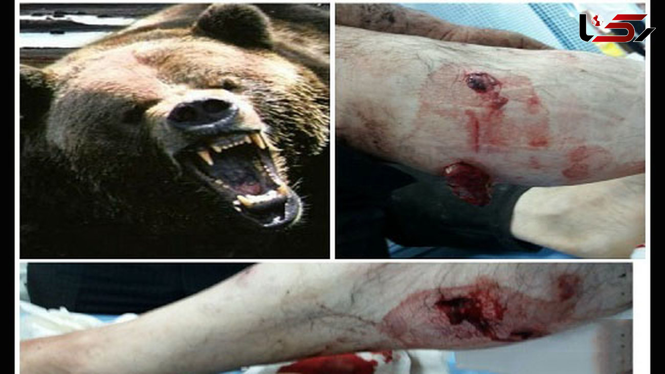 حمله خونین خرس به مرد قزوینی + عکس 
