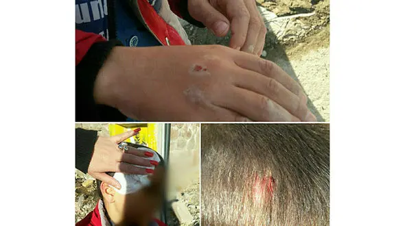 حمله وحشتناک سگ ها ولگرد به یک کودک این بار در حوالی مسکن مهر+عکس