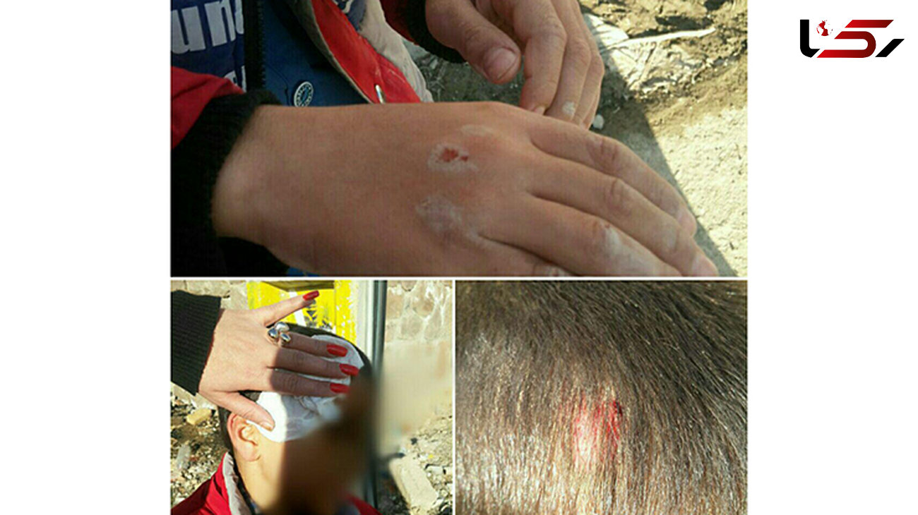 حمله وحشتناک سگ ها ولگرد به یک کودک این بار در حوالی مسکن مهر+عکس