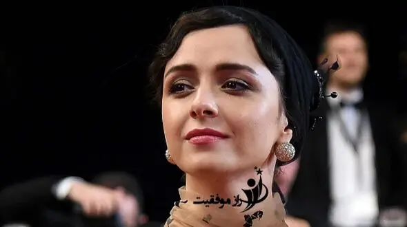 بیماری ترانه علیدوستی چیست؟ / نگاهی به سندرم نادر DRESS و پیامدهای آن