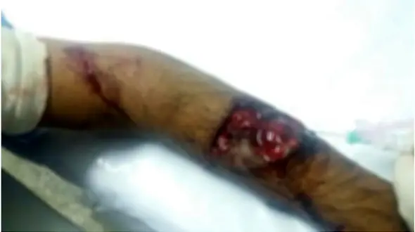 حمله گرگ گرسنه به مرد روستایی / دست مرد جوان کنده شد + عکس 