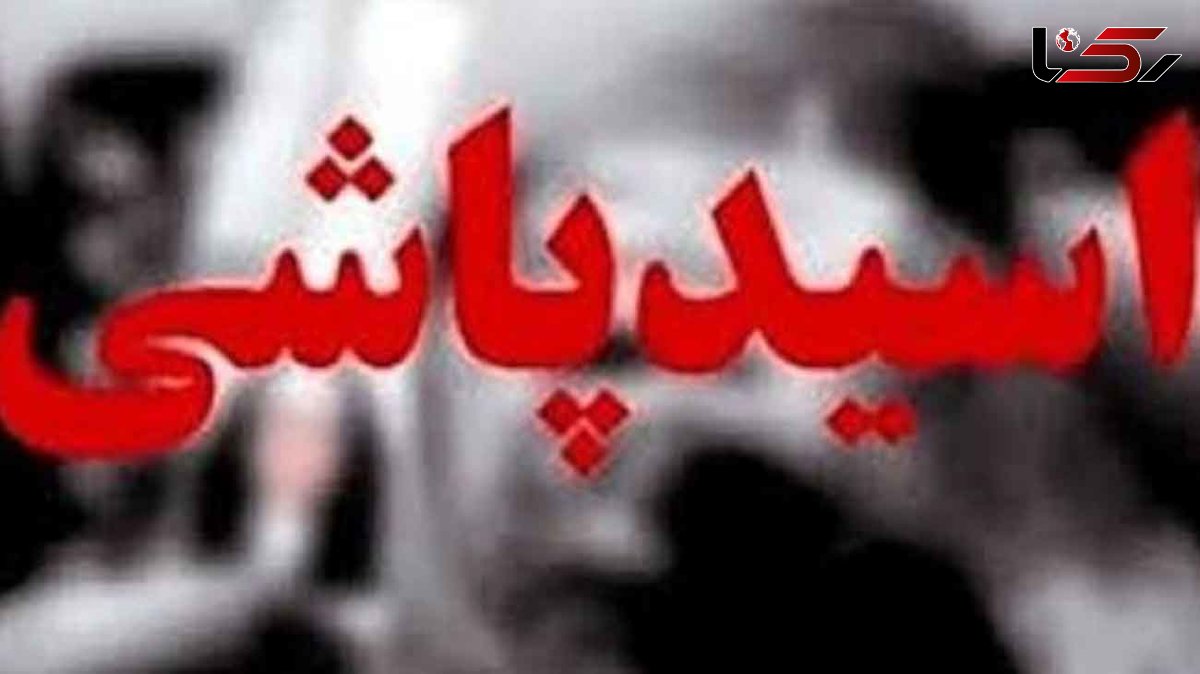 اسیدپاشی زن تهرانی به شوهر  به خاطر رفتن به اروپا