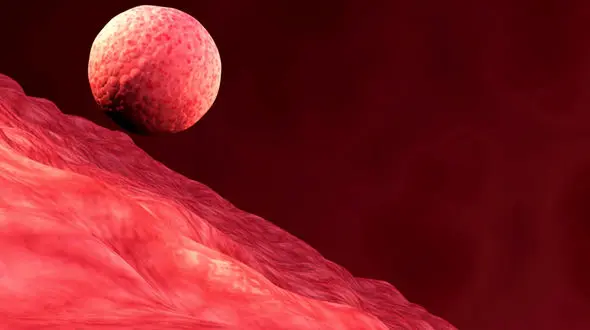 لانه گزینی چیست؟ / زنان باردار حتما بخوانند