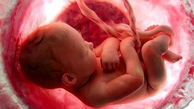 پاسخ استعلام اداره کل حقوقی قوه قضاییه درباره پرداخت دیه جنین دختر