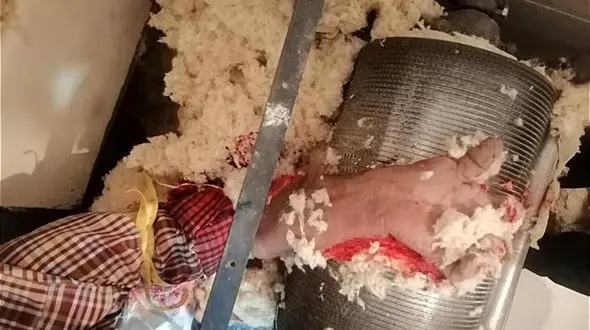 عکس های فجیع از له شدن دست پنبه زن تهرانی