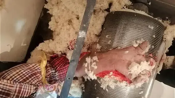 عکس های فجیع از له شدن دست پنبه زن تهرانی