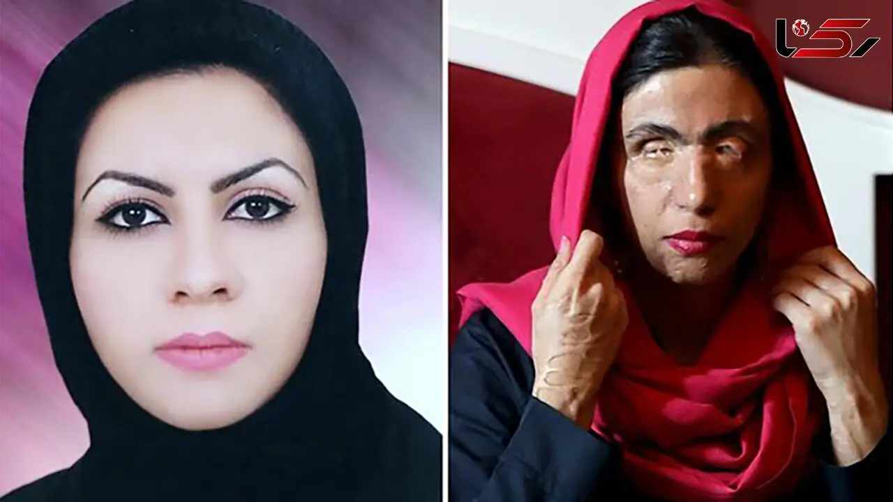 فیلم  / این دختر زیبای ایرانی بعد اسید پاشی جذاب ترن مدل لباس جهان شد / معصومه عطایی با لقب زیباترین زن جهان  درخشید !
