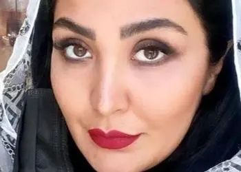 مریم معصومی تغییر چهره داد ؛ خانم بازیگر قابل شناسایی نیست