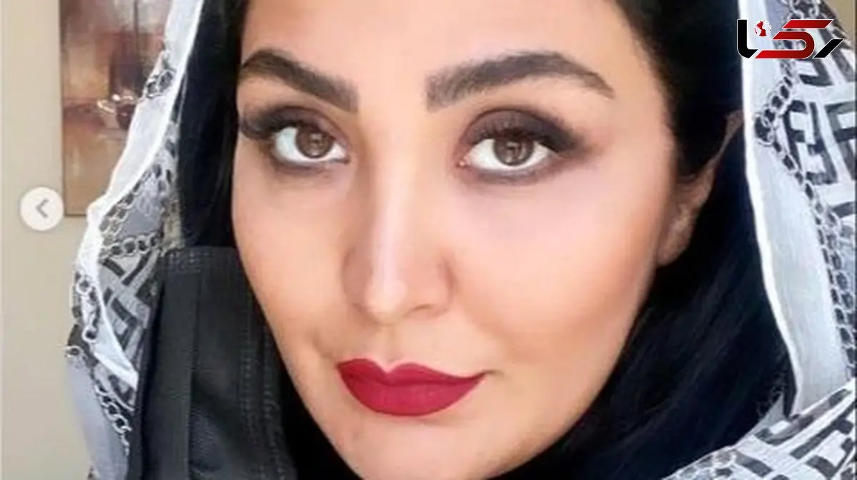 مریم معصومی تغییر چهره داد ؛ خانم بازیگر قابل شناسایی نیست