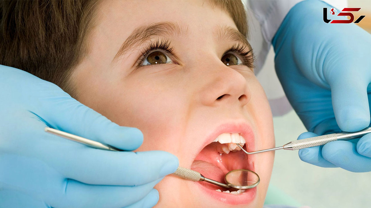 بوفه های مدارس رصد می شوند / جزییات تخفیف ۶۵ درصدی ۸ خدمت دندانپزشکی در مراکز جامع سلامت