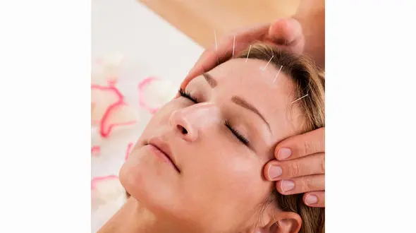 با طب سوزنی به جوان سازی صورت خود کمک کنید