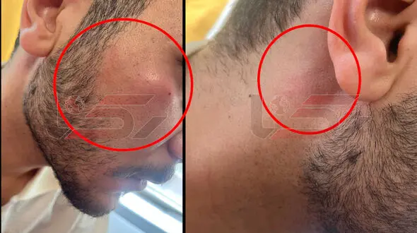 کتک زدن خبرنگار رکنا توسط راننده اسنپ + عکس