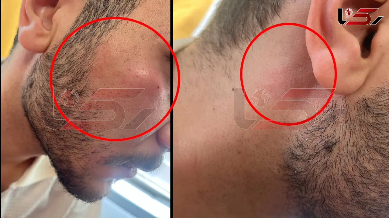 کتک زدن خبرنگار رکنا توسط راننده اسنپ + عکس