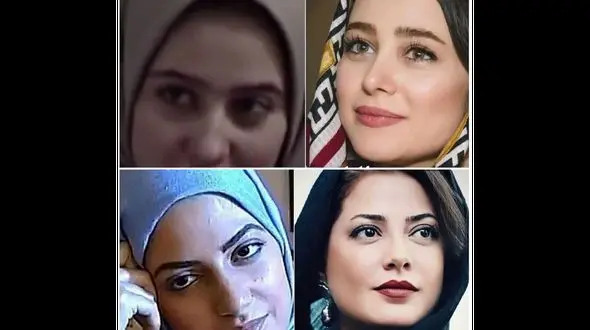 این 8 خانم بازیگر ایرانی صورتشان را از نو ساختند ! / چی بودند و چی شدند باور نمی کنید ! !