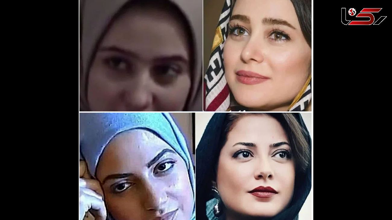 عکس های 8 خانم بازیگر ایرانی که صورتشان را کوبیدند و ساختند ! / همه زیبا هستیم فقط پول نداریم !