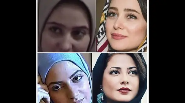 این 8 خانم بازیگر ایرانی صورتشان را از نو ساختند ! / چی بودند و چی شدند باور نمی کنید ! !
