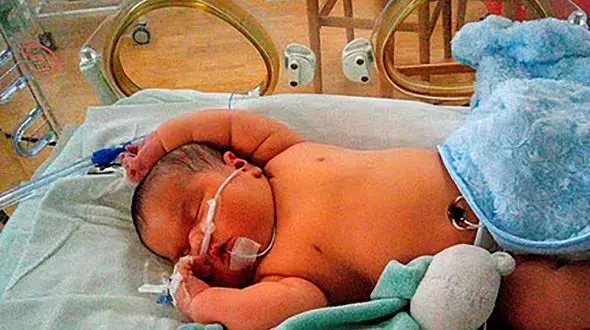 تولد نوزاد 6 کیلویی در بریتانیا + عکس