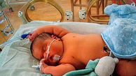 تولد نوزاد 6 کیلویی در بریتانیا + عکس