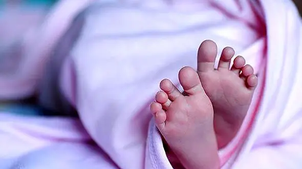 این نوزاد عجیب الخلقه را زنده زنده دفنش کردند+ عکس جگرسوز