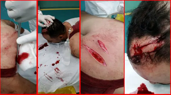 حمله خونین به جوان خرمشهری +عکس 16+