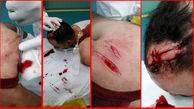 حمله خونین به جوان خرمشهری +عکس 16+