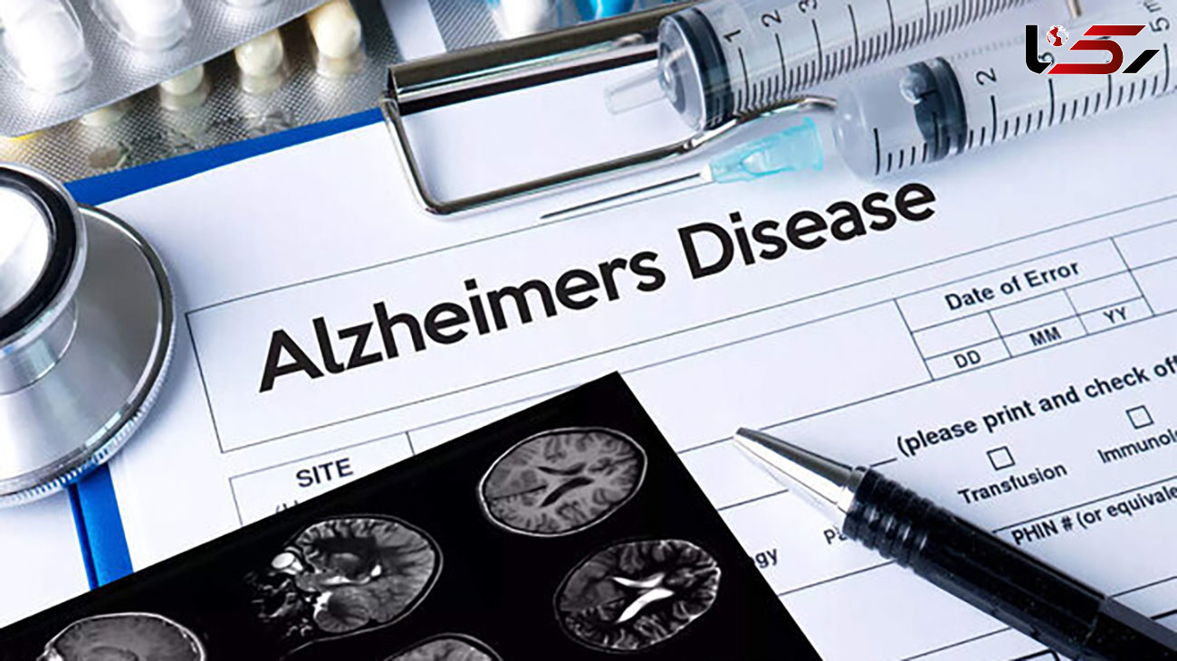 می دانید علائم اولیه آلزایمر در کدام بخش بدن ظاهر می‌ شود؟