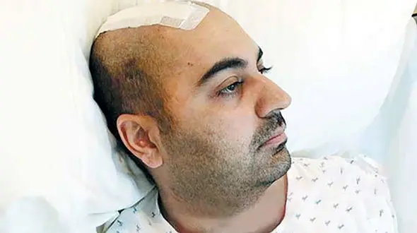  پروفسور سمیعی، بهنام صفوی را جراحی کرد + عکس