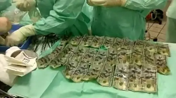  زنی از ترس همسرش ۷ هزار دلار را بلعید+ عکس