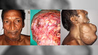 جراحی عجیب گردن یک مرد  + تصاویر 16+
