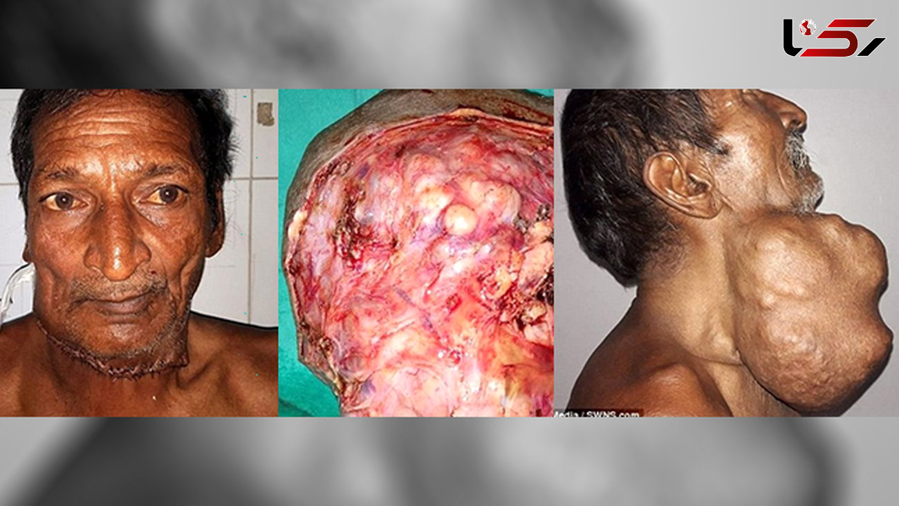 جراحی عجیب گردن یک مرد  + تصاویر 16+