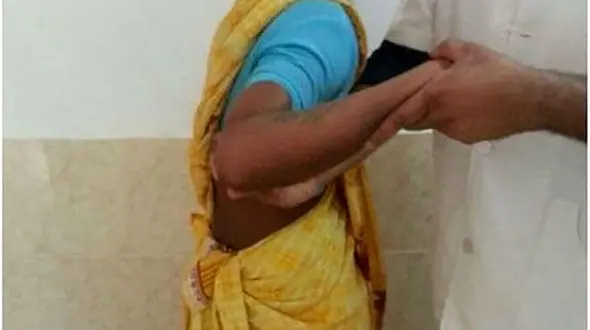 چرخش 180 درجه ای شانه زن جوان / استخوان شانه این زن گم شده ! + عکس 