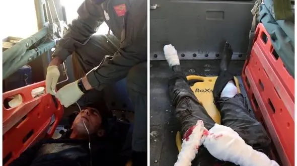 قطه 3 انگشت نوجوان ۱۵ ساله ای در چهارشنبه سوری + عکس