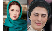 بازیگران ایرانی که بیماری ام اس دارند + اسامی و عکس های 5 بازیگر