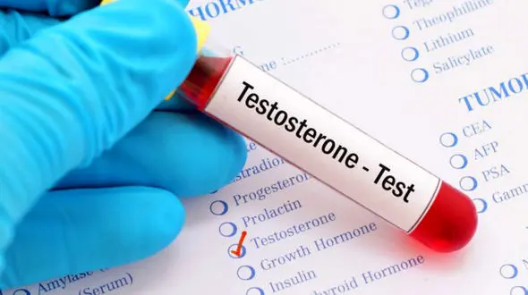 تستوسترون چیست؟ + جدول تستوسترون تفاوت با هورمون رشد و مقایسه مردان با زنان