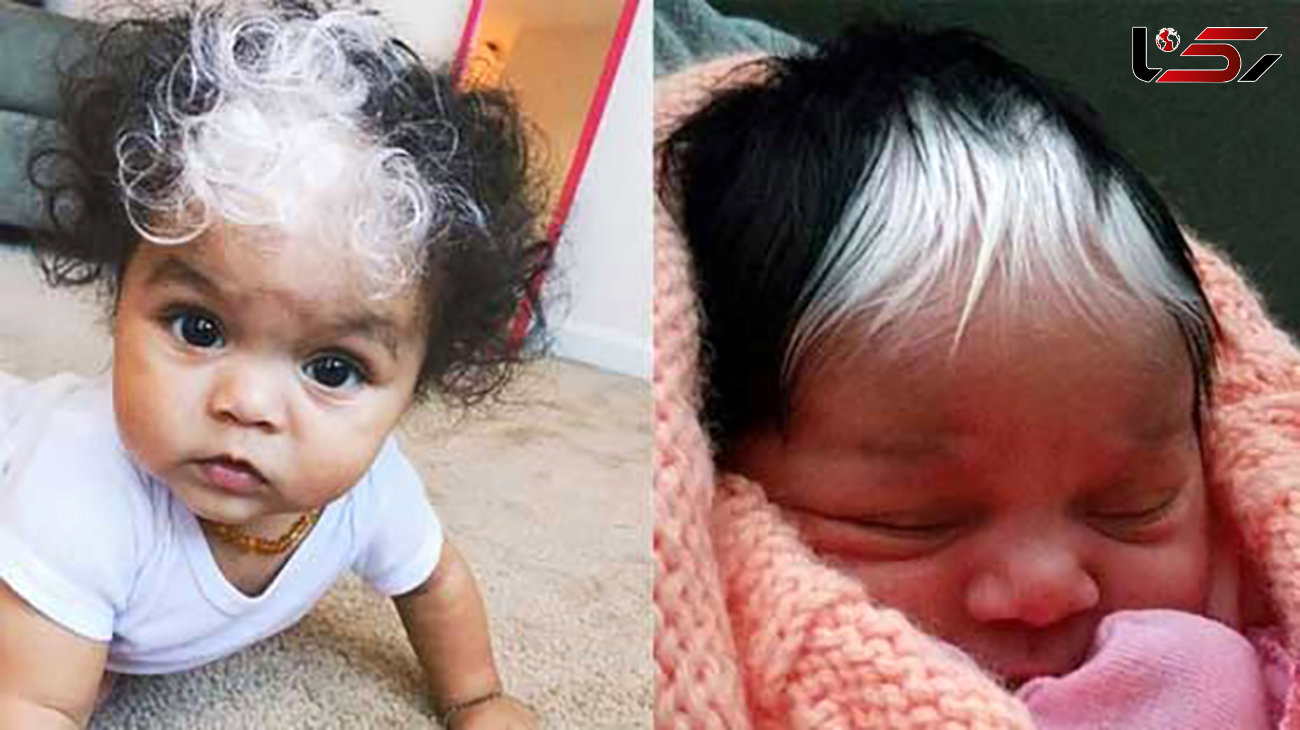  نوزادی با موهای سفید! +عکس 