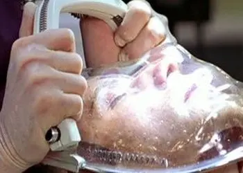 لحظه ای تکان دهنده: صورت انسان جدا شده برای پیوند زدن! (تصویر هولناک)