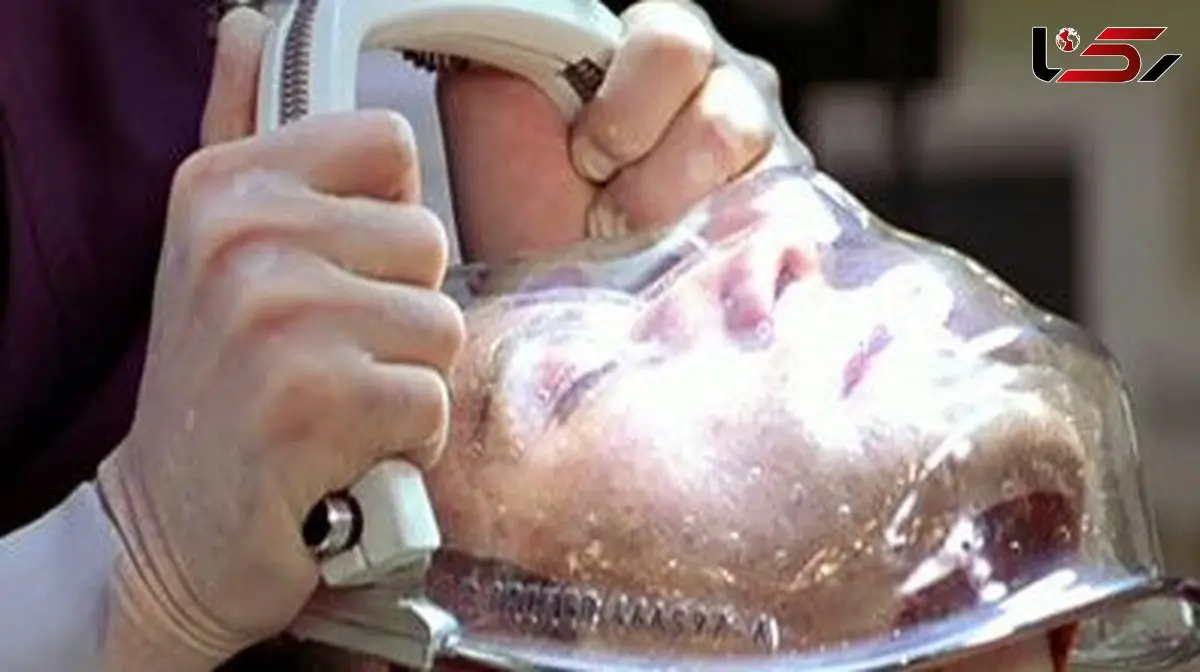 لحظه ای تکان دهنده: صورت انسان جدا شده برای پیوند زدن! (تصویر هولناک)