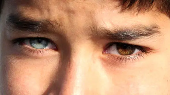 
ستاره‌های معروفی که دو رنگ چشم متفاوت دارند!
