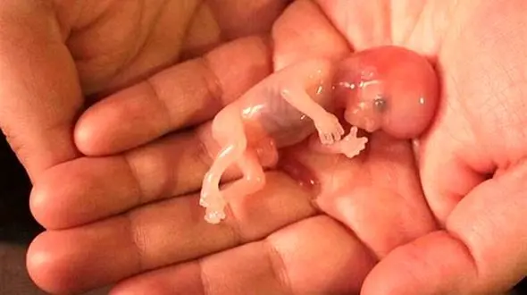 سقط جنین در لهستان ممنوع شد