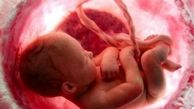  ۱۲۷۶ زن تهرانی خواستارسقط جنین شدند 