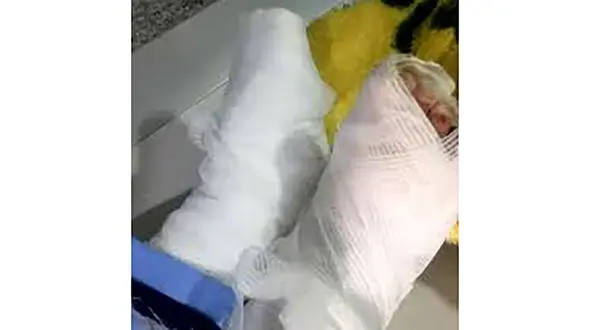 آخرین وضعیت کودک آزار دیده سبزواری + فیلم